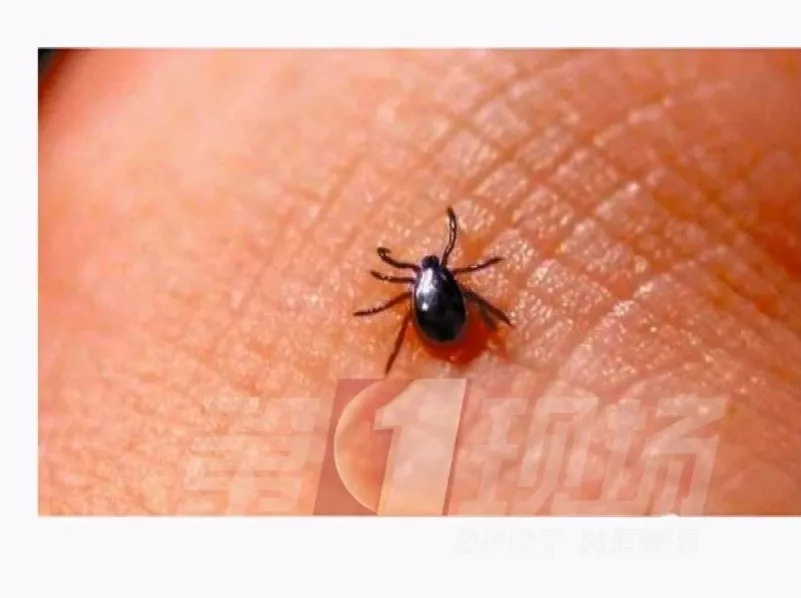 当心!深圳男童被这种小虫咬后高烧10天未退,严重可致命